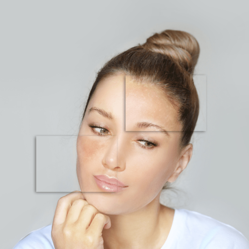 Causes et traitement des taches brunes sur la peau